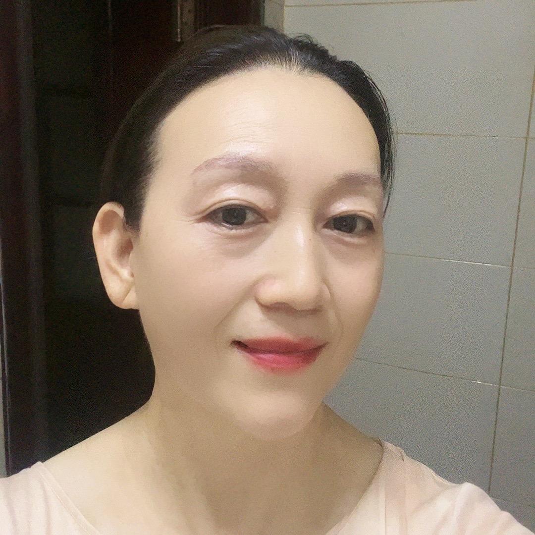 宜诺张