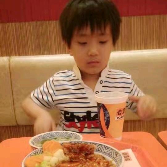 吊线风面瘫
