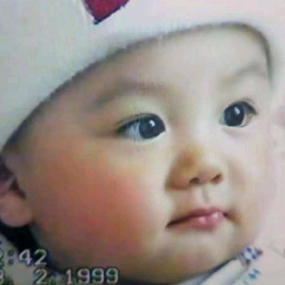 有眼袋